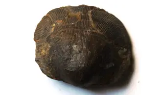 DESQUAMATIA SUBZONATA