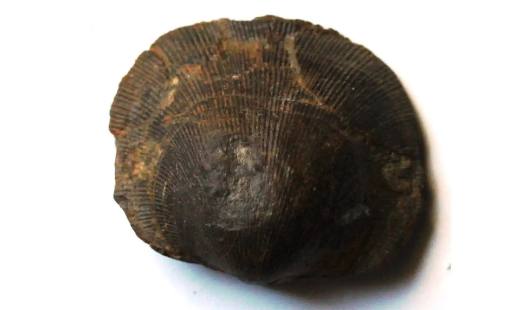 DESQUAMATIA SUBZONATA